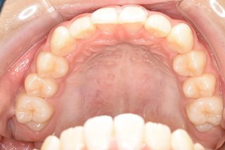 ビフォー_03 after01