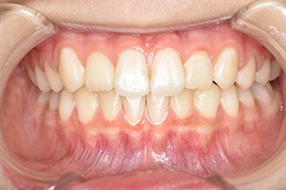 ビフォー_03 after03