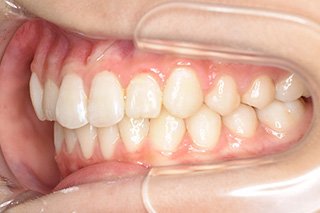 ビフォー_03 after04