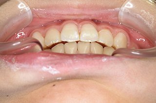 ビフォー_03 after05