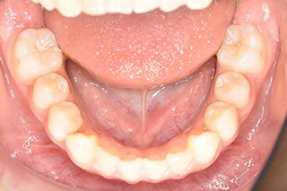 ビフォー_03 after06