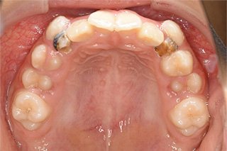 ビフォー_03 Before01