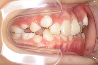 ビフォー_03 Before02