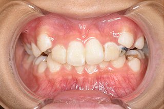 ビフォー_03 Before03