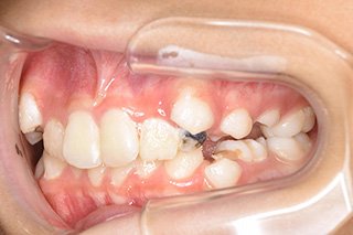 ビフォー_03 Before04