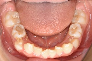 ビフォー_03 Before06