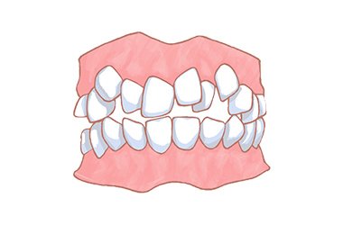 叢生（そうせい） イメージ