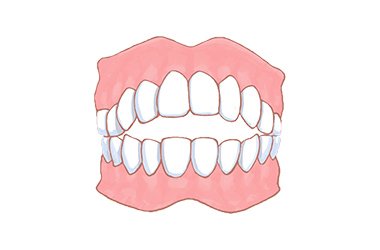 開咬（かいこう） イメージ