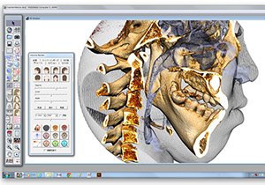 カラム_04 イメージ1
