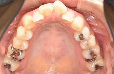 ビフォー_01 before