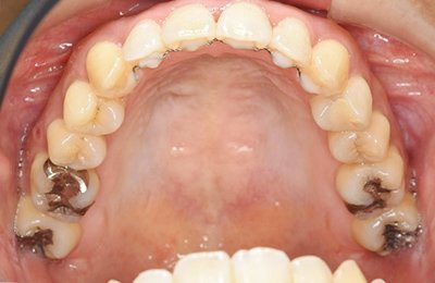 ビフォー_01 after