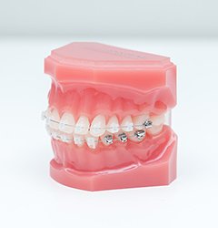 リード_06 イメージ3