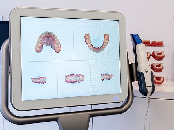 トピックス_04 イメージ