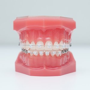 タイプ_01 イメージ2