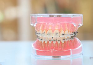 決められた治療法で進めること イメージ