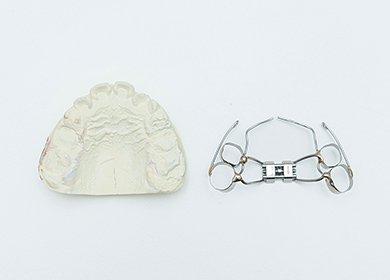 顎顔面矯正とは イメージ