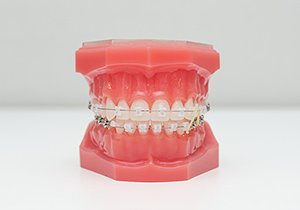 カラム_04 イメージ1